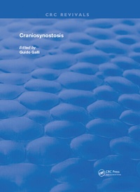 Abbildung von: Craniosynostosis - CRC Press