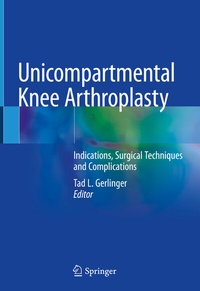 Abbildung von: Unicompartmental Knee Arthroplasty - Springer