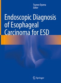 Abbildung von: Endoscopic Diagnosis of Esophageal Carcinoma for ESD - Springer