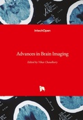 Cover: Advances in Brain Imaging - In Tech