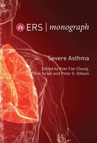 Abbildung von: Severe Asthma - European Respiratory Society