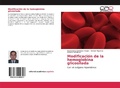 Cover: Modificaci&oacute;n de la hemoglobina glicosilada - Editorial Acad&eacute;mica Espa&ntilde;ola