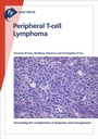 Cover: Fast Facts: Peripheral T-cell Lymphoma - Health Press Limited
