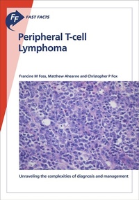 Enlarge image Cover: Fast Facts: Peripheral T-cell Lymphoma - Health Press Limited