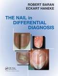 Cover: Nail in Differential Diagnosis - CRC Press
