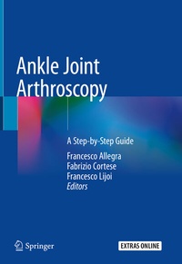 Abbildung von: Ankle Joint Arthroscopy - Springer