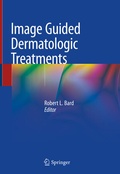 Cover: Image Guided Dermatologic Treatments - Springer
