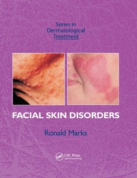 Enlarge image Cover: Facial Skin Disorders - CRC Press