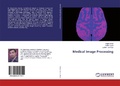 Cover: Medical Image Processing - LAP Lambert Academic Publishing