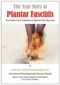 Cover: The True Story of Plantar Fasciitis: And Why Heel Injections Should Be Banned - Velum