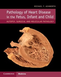 Abbildung von: Pathology of Heart Disease in the Fetus, Infant and Child - Cambridge University Press