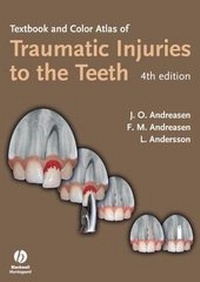 Enlarge image Cover: Textbook and Color Atlas of Traumatic Injuries to the Teeth - Wiley-Blackwell