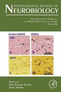 Abbildung von: New Therapeutic Strategies for Brain Edema and Cell Injury - Academic Press