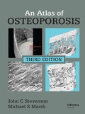 Cover: An Atlas of Osteoporosis - CRC Press