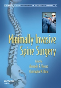 Enlarge image Cover: Minimally Invasive Spine Surgery - CRC Press