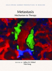 Abbildung von: Metastasis: Mechanism to Therapy - Cold Spring Harbor Laboratory Press,U.S.
