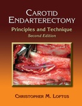 Cover: Carotid Endarterectomy - CRC Press