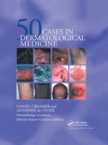 Cover: Fifty Dermatological Cases - CRC Press