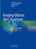 Abbildung von: Imaging Gliomas After Treatment - Springer