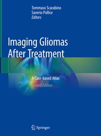 Abbildung von: Imaging Gliomas After Treatment - Springer