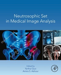 Enlarge image Cover: Neutrosophic Set in Medical Image Analysis - Academic Press