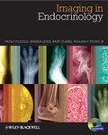 Cover: Imaging in Endocrinology - Wiley-Blackwell