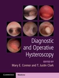 Enlarge image Cover: Diagnostic and Operative Hysteroscopy - Cambridge University Press