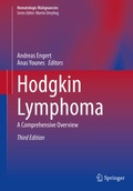 Cover: Hodgkin Lymphoma - Springer