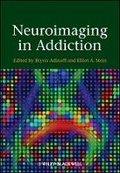 Bild: Neuroimaging in Addiction - Wiley