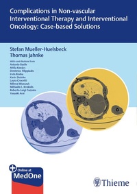 Abbildung von: Complications in Non-vascular Interventional Therapy and Interventional Oncology: Case-based Solutions - Thieme