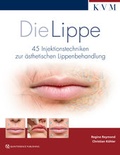 Cover: Die Lippe - KVM - Der Medizinverlag
