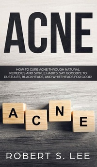 Abbildung von: Acne - Maria Fernanda Moguel Cruz