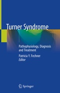 Abbildung von: Turner Syndrome - Springer