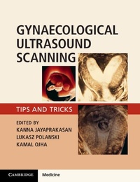 Abbildung von: Gynaecological Ultrasound Scanning - Cambridge University Press