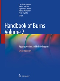 Abbildung von: Handbook of Burns Volume 2 - Springer