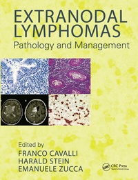 Enlarge image Cover: Extranodal Lymphomas - CRC Press