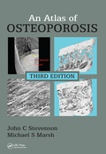 Cover: An Atlas of Osteoporosis - CRC Press