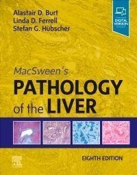 Abbildung von: MacSween's Pathology of the Liver - Elsevier