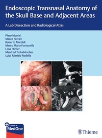 Abbildung von: Endoscopic Transnasal Anatomy of the Skull Base and Adjacent Areas - Thieme
