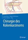 Cover: Chirurgie des Kolonkarzinoms - Springer