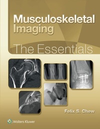 Abbildung von: Musculoskeletal Imaging: The Essentials - Wolters Kluwer Health