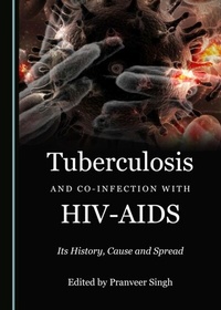Abbildung von: Tuberculosis and Co-infection with HIV-AIDS - Cambridge Scholars Publishing