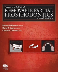 Abbildung von: Stewart's Clinical Removable Partial Prosthodontics - Quintessence Publishing Co, Inc