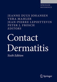 Abbildung von: Contact Dermatitis - Springer
