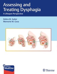 Abbildung von: Assessing and Treating Dysphagia - Thieme Publishers