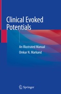 Abbildung von: Clinical Evoked Potentials - Springer