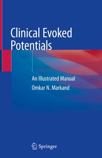 Abbildung von: Clinical Evoked Potentials - Springer