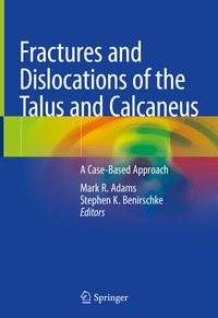 Abbildung von: Fractures and Dislocations of the Talus and Calcaneus - Springer