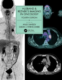 Abbildung von: Husband & Reznek's Imaging in Oncology - CRC Press