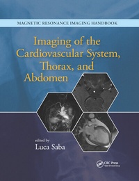 Enlarge image Cover: Imaging of the Cardiovascular System, Thorax, and Abdomen - CRC Press